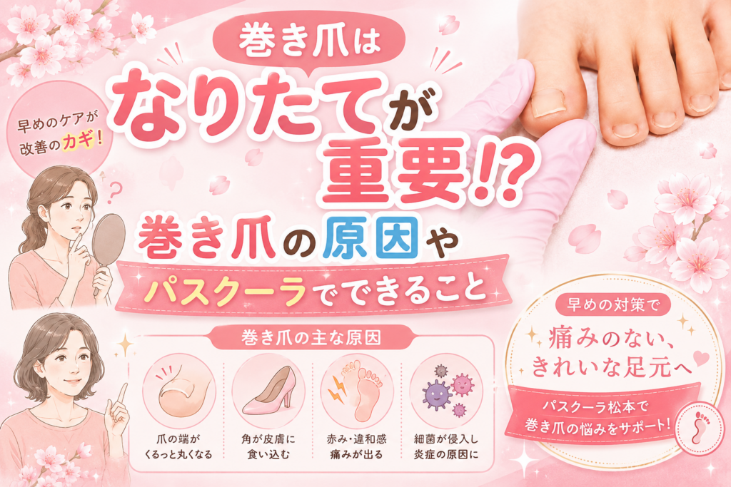 【巻き爪】巻き爪はなりたてが重要⁉巻き爪の原因やパスクーラでできること
