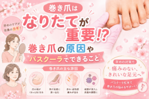 【巻き爪】巻き爪はなりたてが重要⁉巻き爪の原因やパスクーラでできること